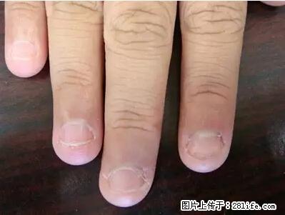 剪指甲、挖耳屎，这些日常小动作竟隐藏大危害！ - 营口生活资讯 - 营口28生活网 yk.28life.net
